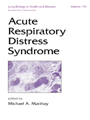 cover image of Acute Respiratory Distress Syndrome